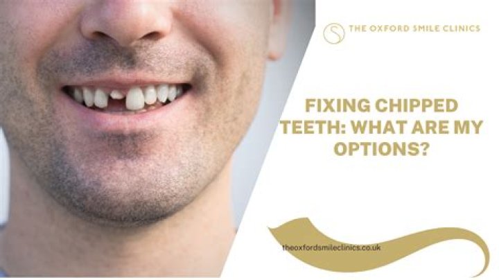 Can a chipped front tooth be fixed?