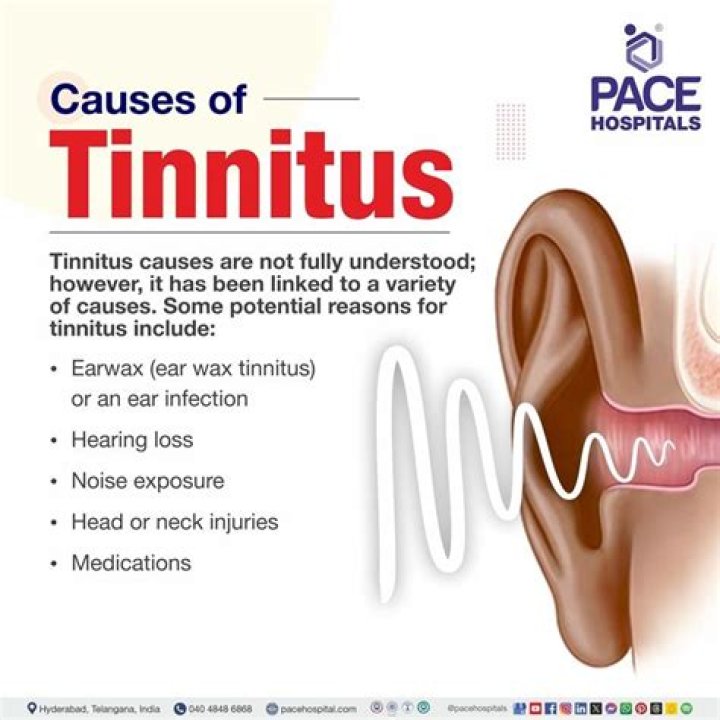 Can a virus cause tinnitus?