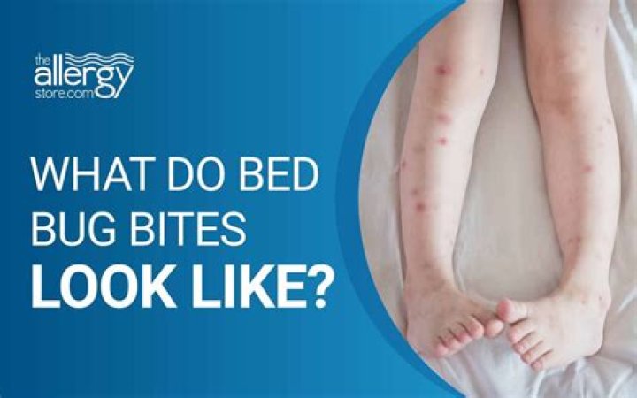 Can bed bug bites make a child sick?