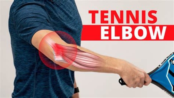 Can computer cause tennis elbow?