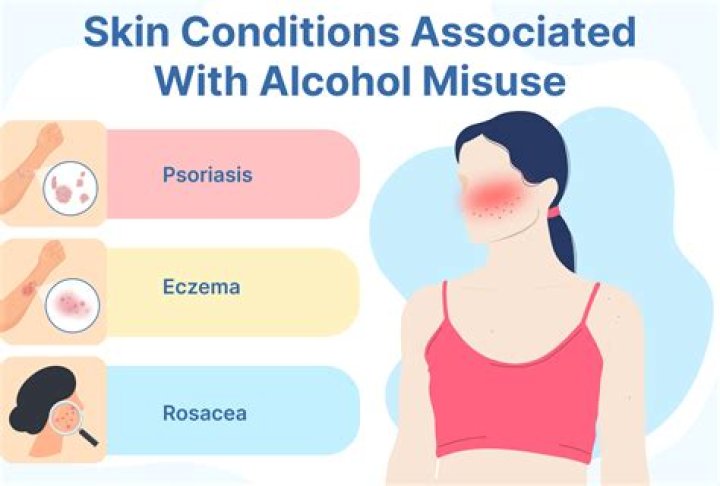 Can excessive drinking cause skin rashes?