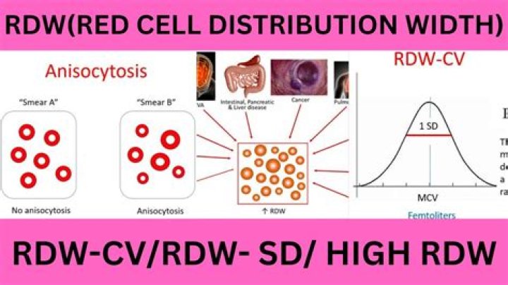 Can high RDW mean cancer?