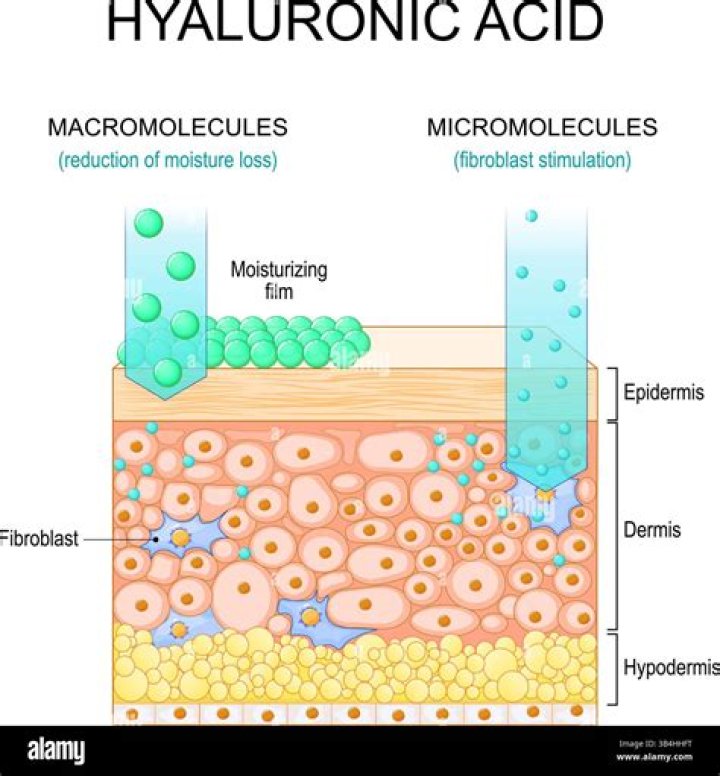 Can hyaluronic acid clog pores?