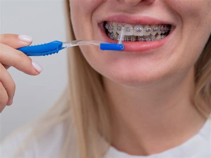Can I use a normal toothbrush with braces?