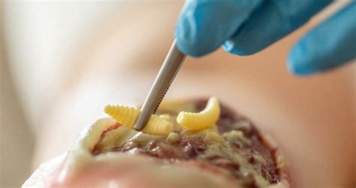 Can maggots go inside your body?