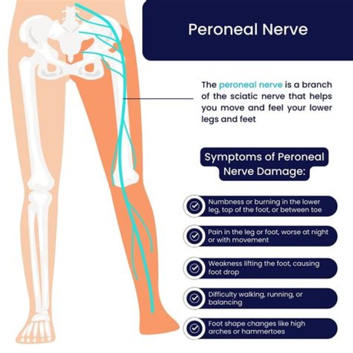Can nerve problems cause chest pain?
