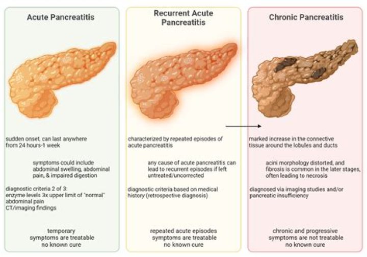 Can pancreatitis be caused by virus?