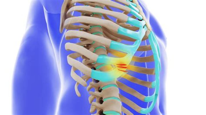 Can sneezing cause rib pain?