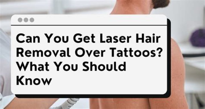 Can you get laser hair removal over tattoos?