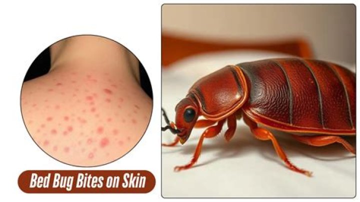Can you have bed bugs in your hair?