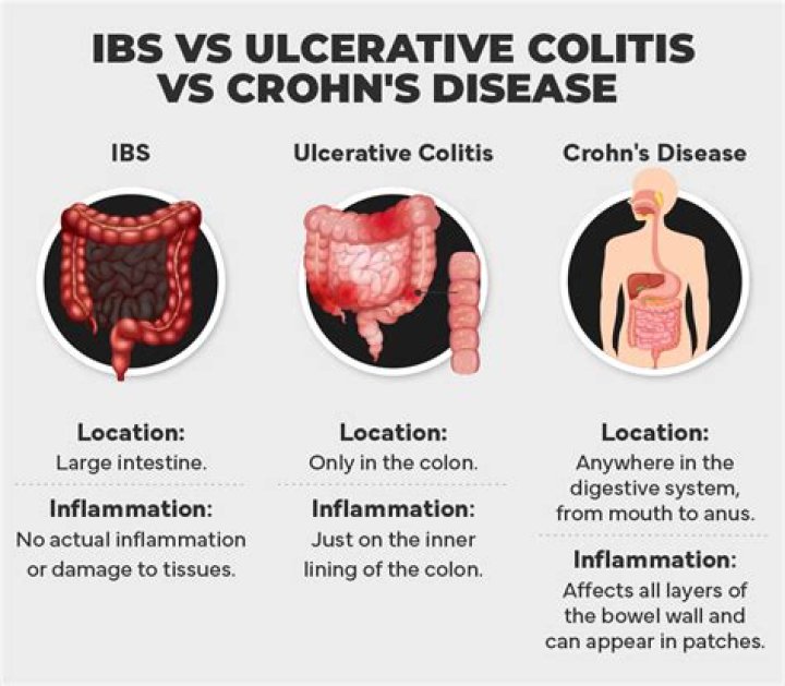 Can you have both UC and Crohn's?