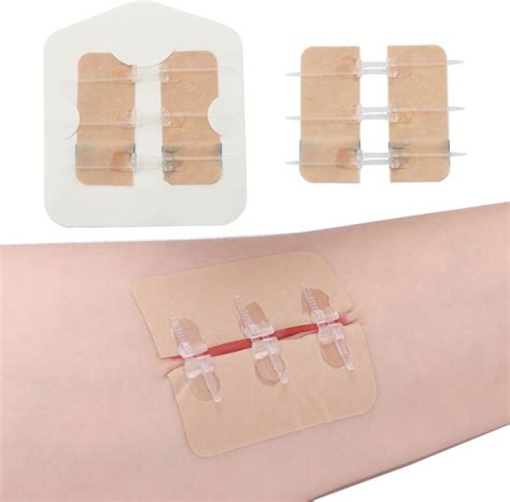 Can you plaster without tape?