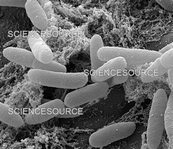 Can you see E coli under a microscope?