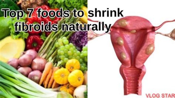 Can you shrink fibroids naturally?