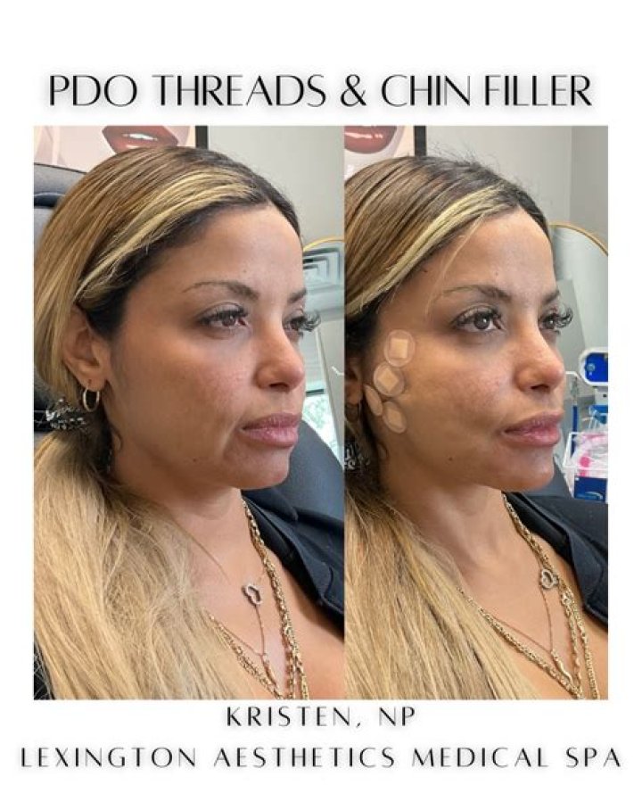 Can you thread chin hair?