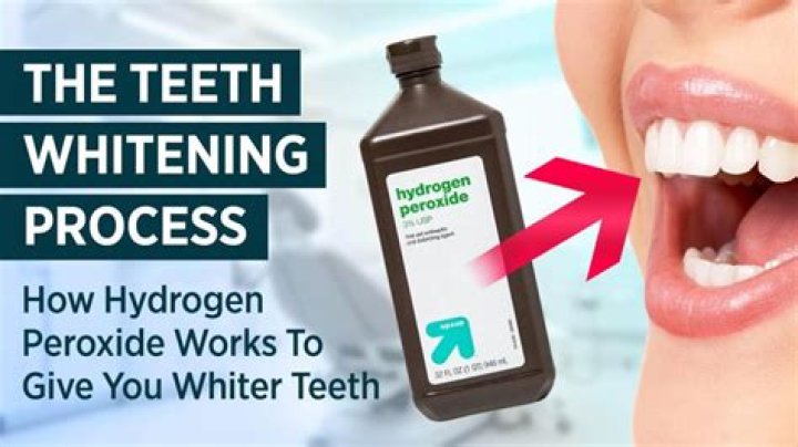 Can you use 35 hydrogen peroxide to whiten teeth?