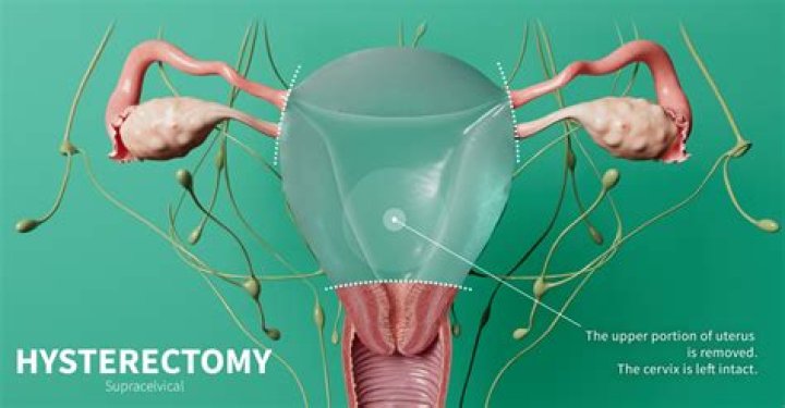 Do dentures have to be removed during surgery?