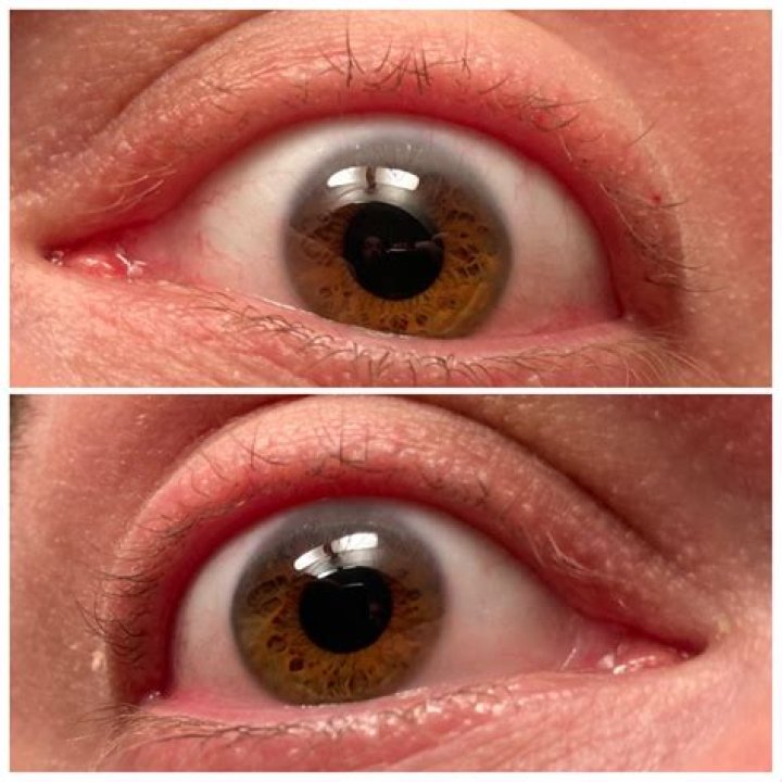 Do eyelashes grow back if you pluck them?