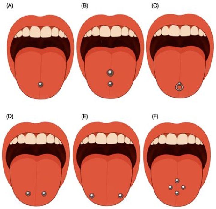 Do nape piercings hurt?