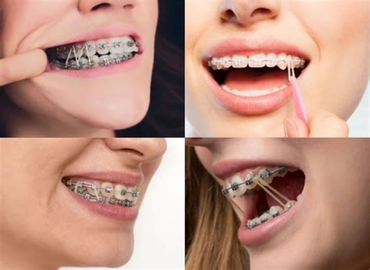 Do rubber bands decompose?