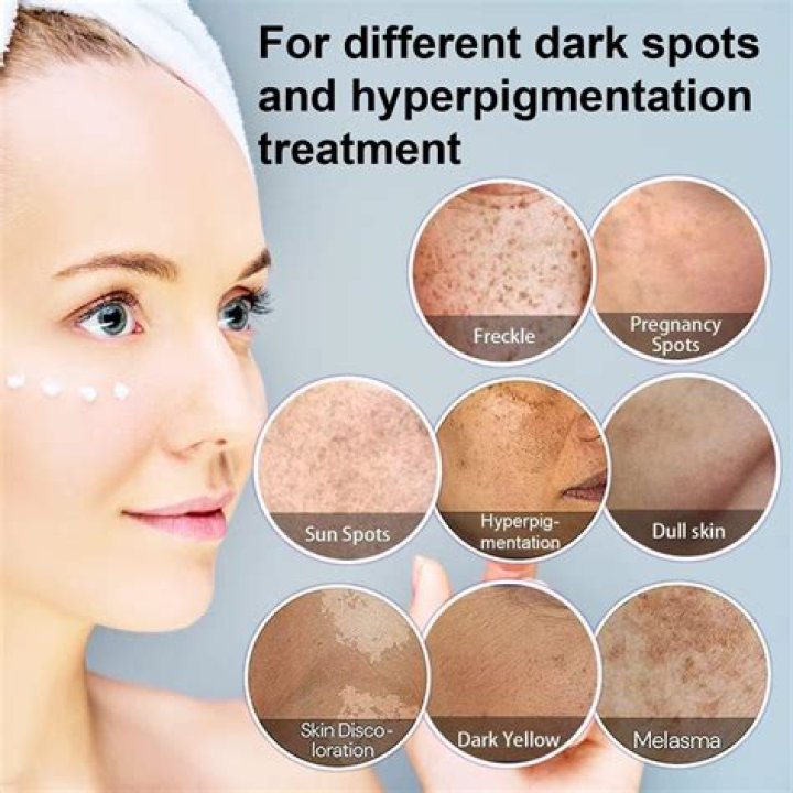 Do you put spot treatment on before moisturizer?