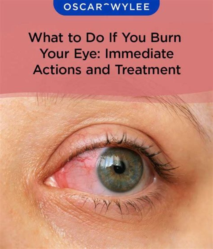 Do your eyes burn when you are tired?