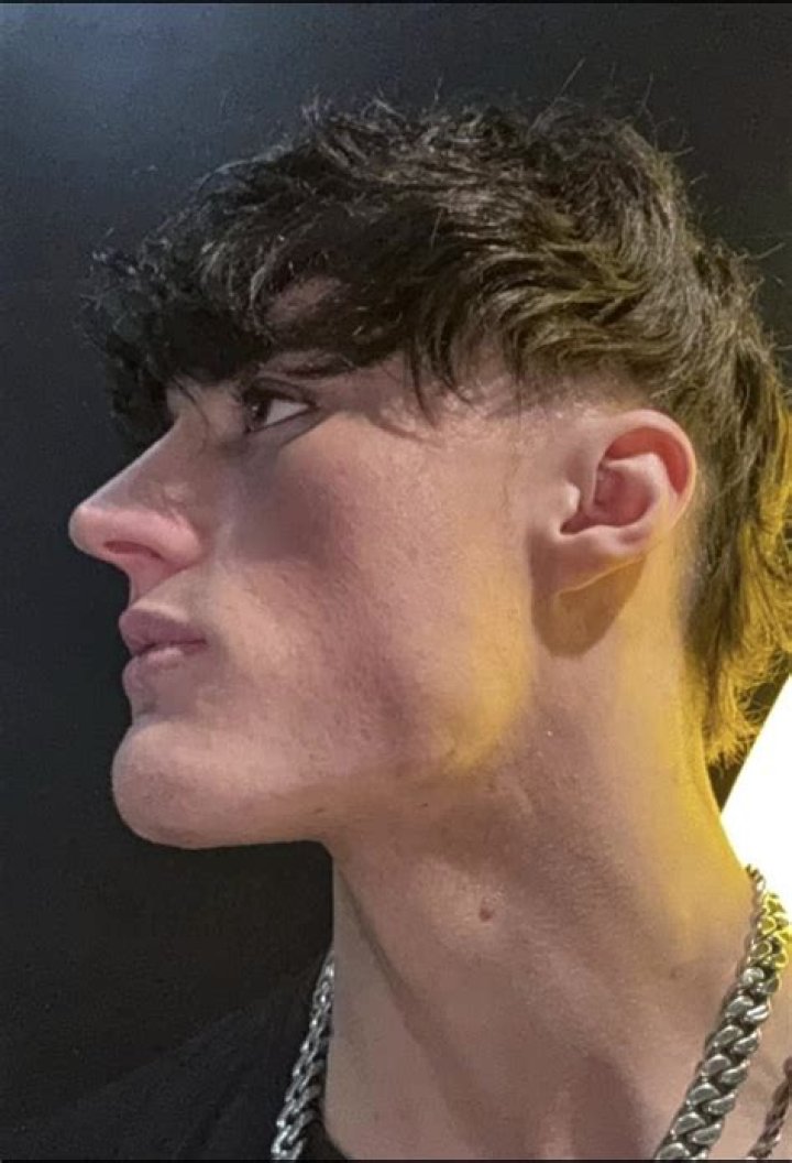 Does 1 Andro burn fat?