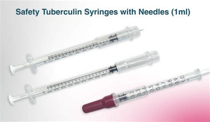 Does a TB shot hurt?