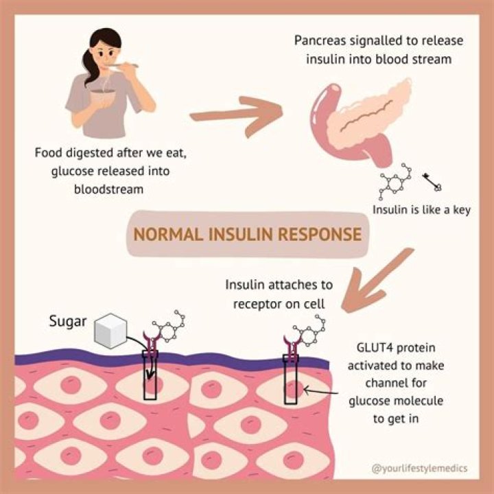 Does epinephrine cause insulin resistance?