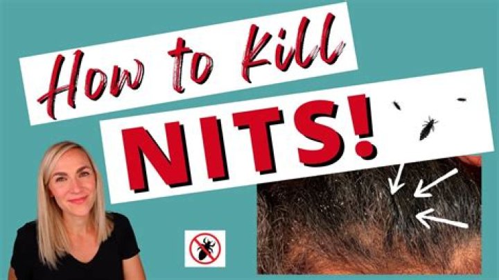 Does Flat Iron kill nits?