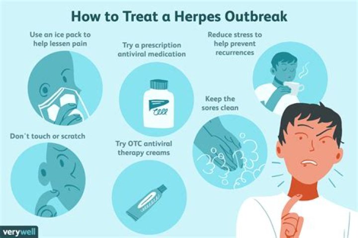 Does herpes go away without treatment?