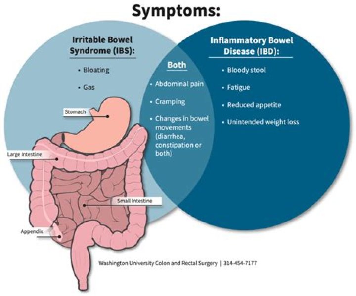 Does IBS cause a noisy stomach?
