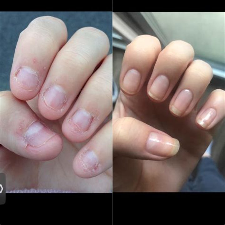 Does nail polish make nails grow?