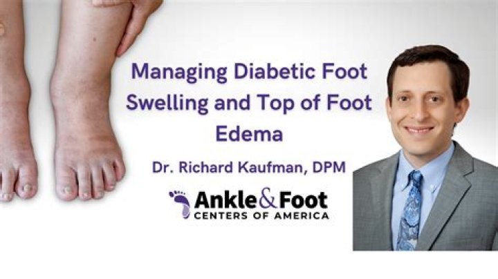 Does sea salt help swollen feet?