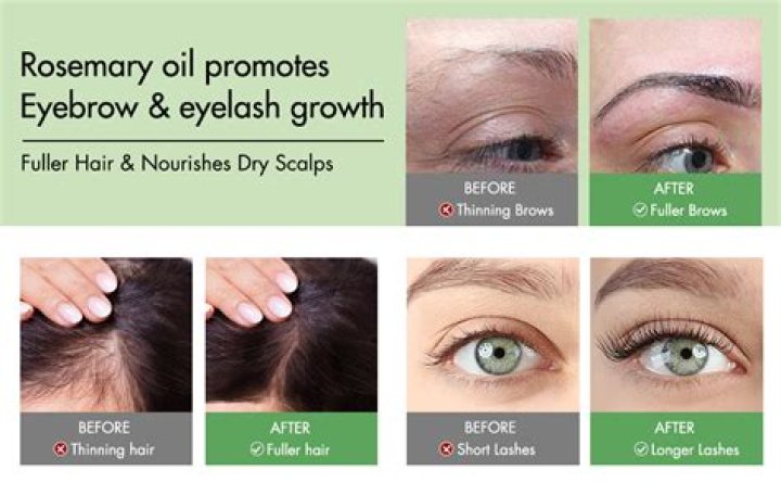 Does tea tree oil grow eyebrows?