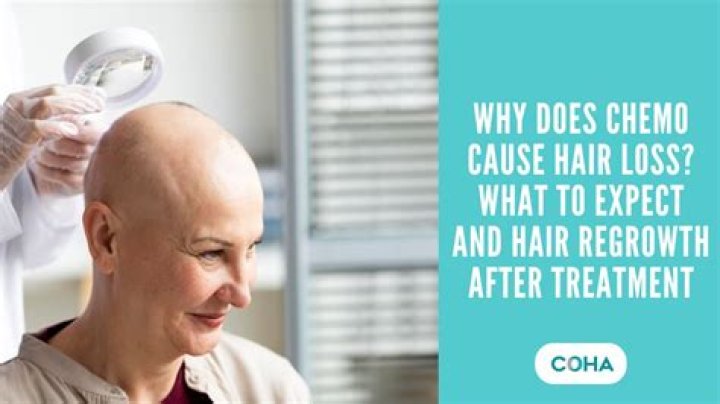 How can I cover my head after chemo?