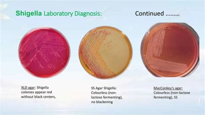 How common is salmonella in pork?
