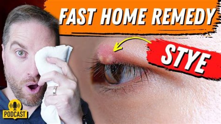 How do I get rid of inflammation in my eye?