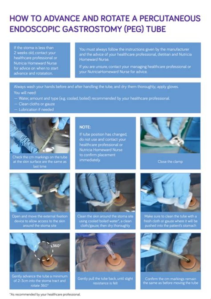 How do you check residual on a PEG tube?