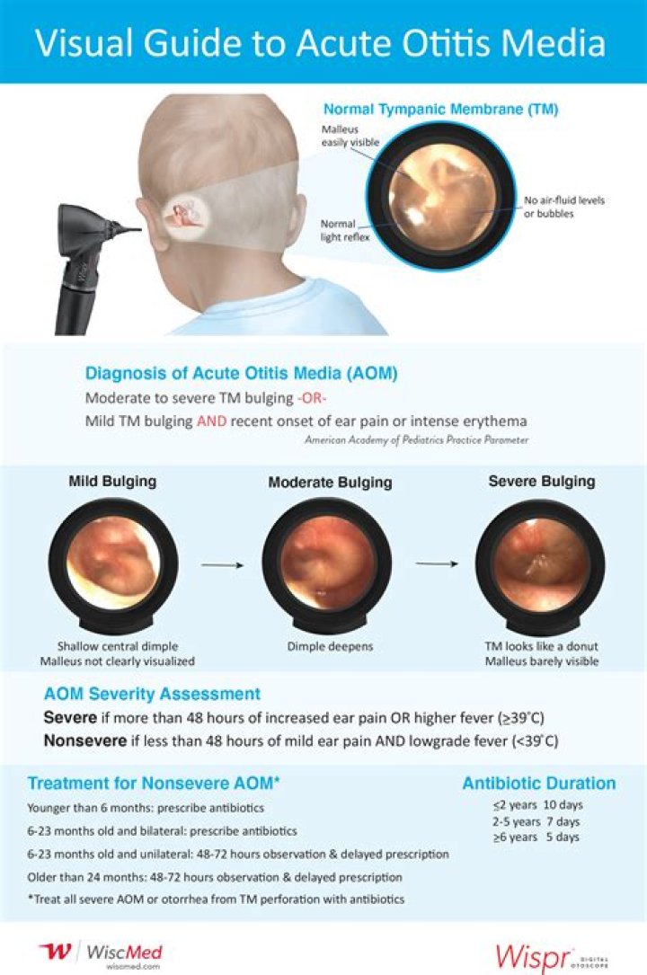 How do you get acute otitis media?