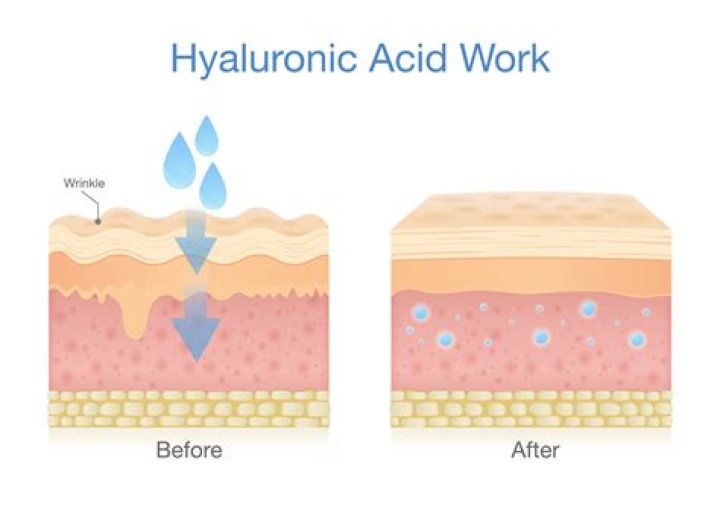 How do you increase skin elasticity?