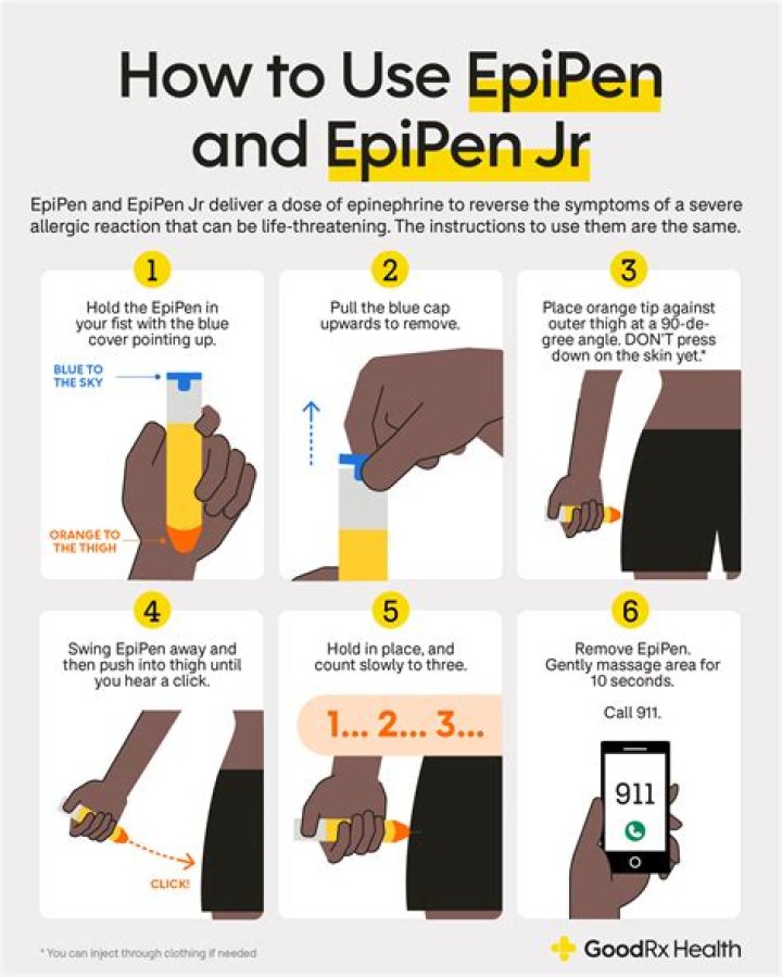 How do you know if you have EPI?