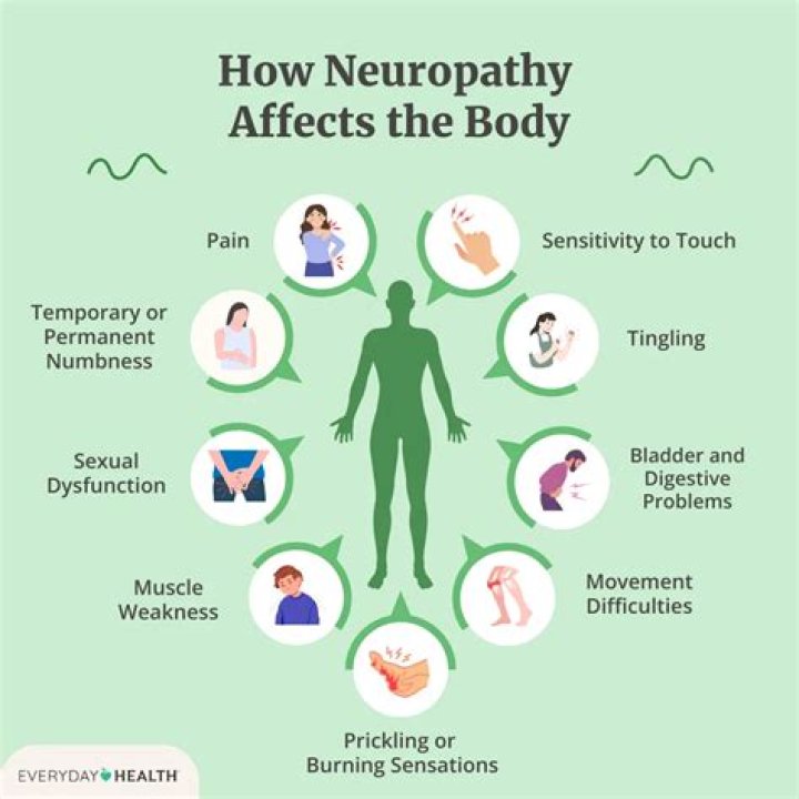 How do you prove neuropathy?
