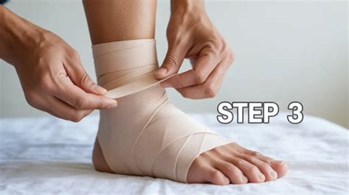 How do you tape a sprained foot?