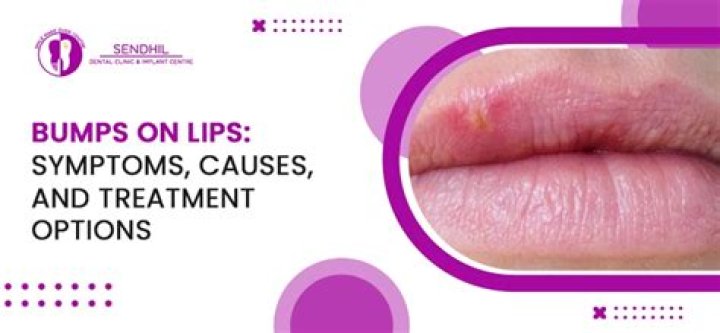 How do you treat a bump on your lip?