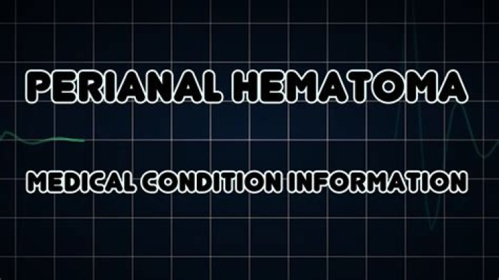 How do you treat a perianal hematoma?