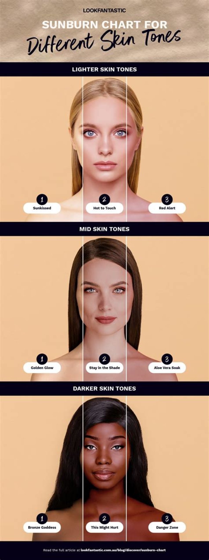 How do you treat sunburn on your face?