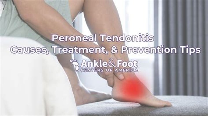 How do you wrap a foot with peroneal tendonitis?
