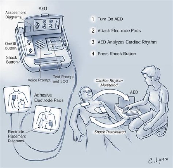 How does a defibrillator work?