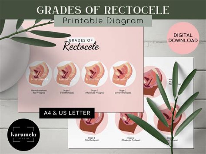 How does a Rectocele feel?